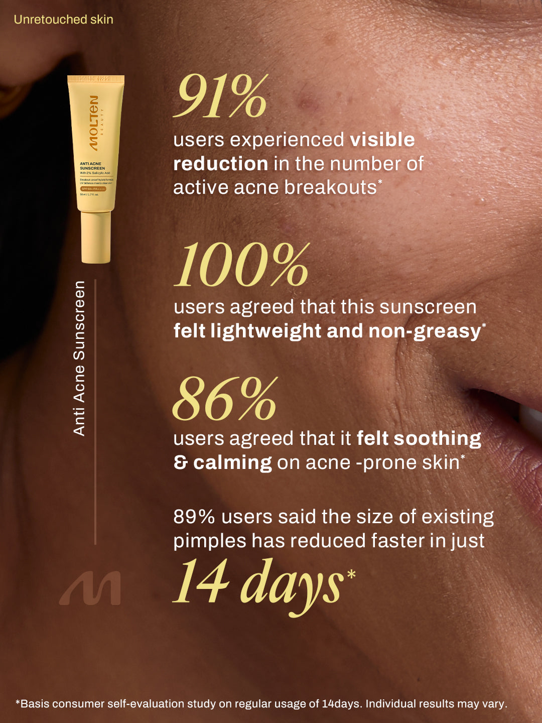 Anti Acne Sunscreen