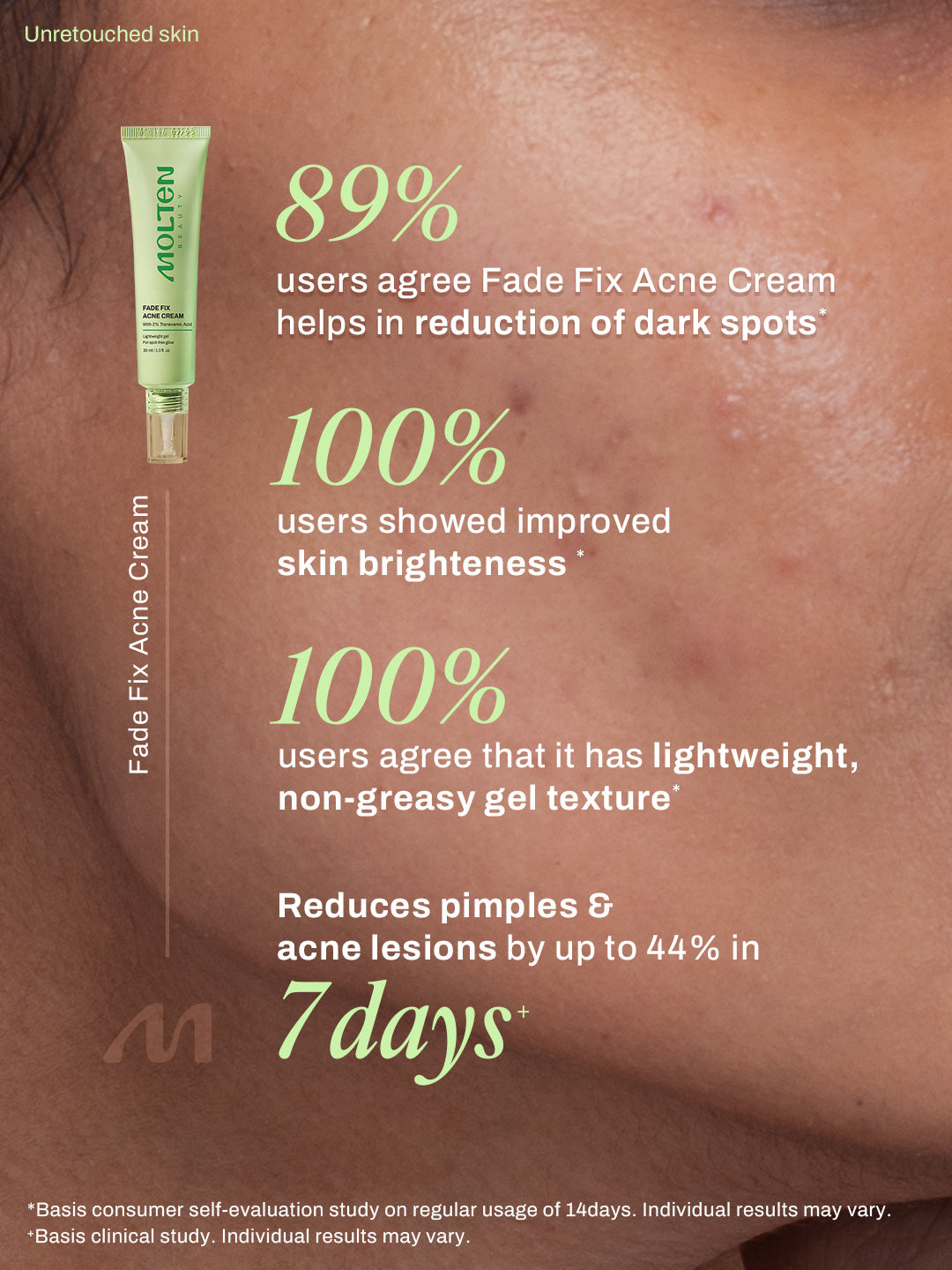 Fade Fix Acne Cream