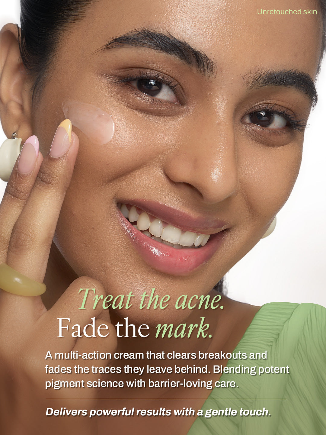 Fade Fix Acne Cream