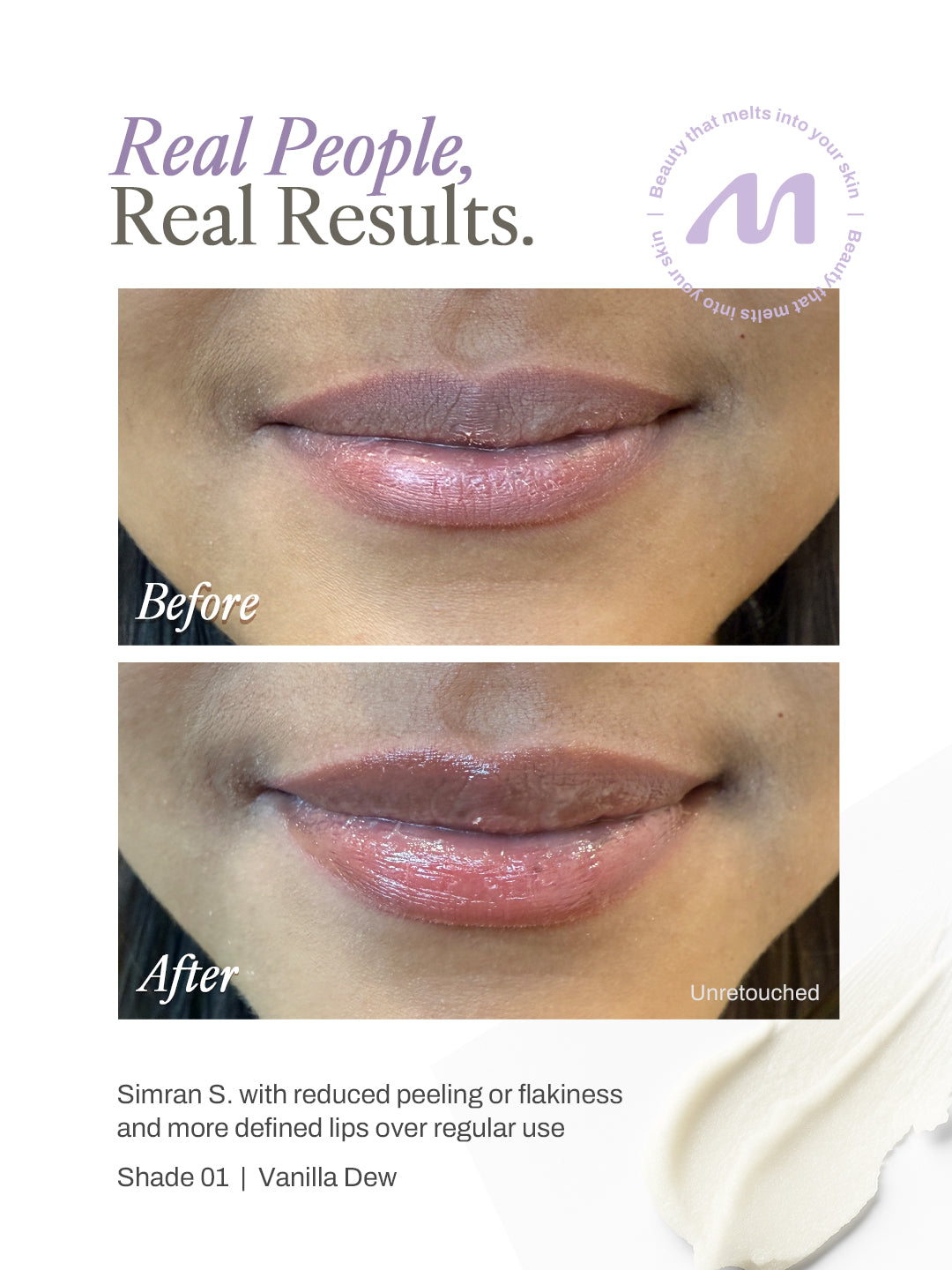 glutathione lip balm before and after results DERMDOC Smooth & Even Duo Turmeric and Lemon Lip Balm