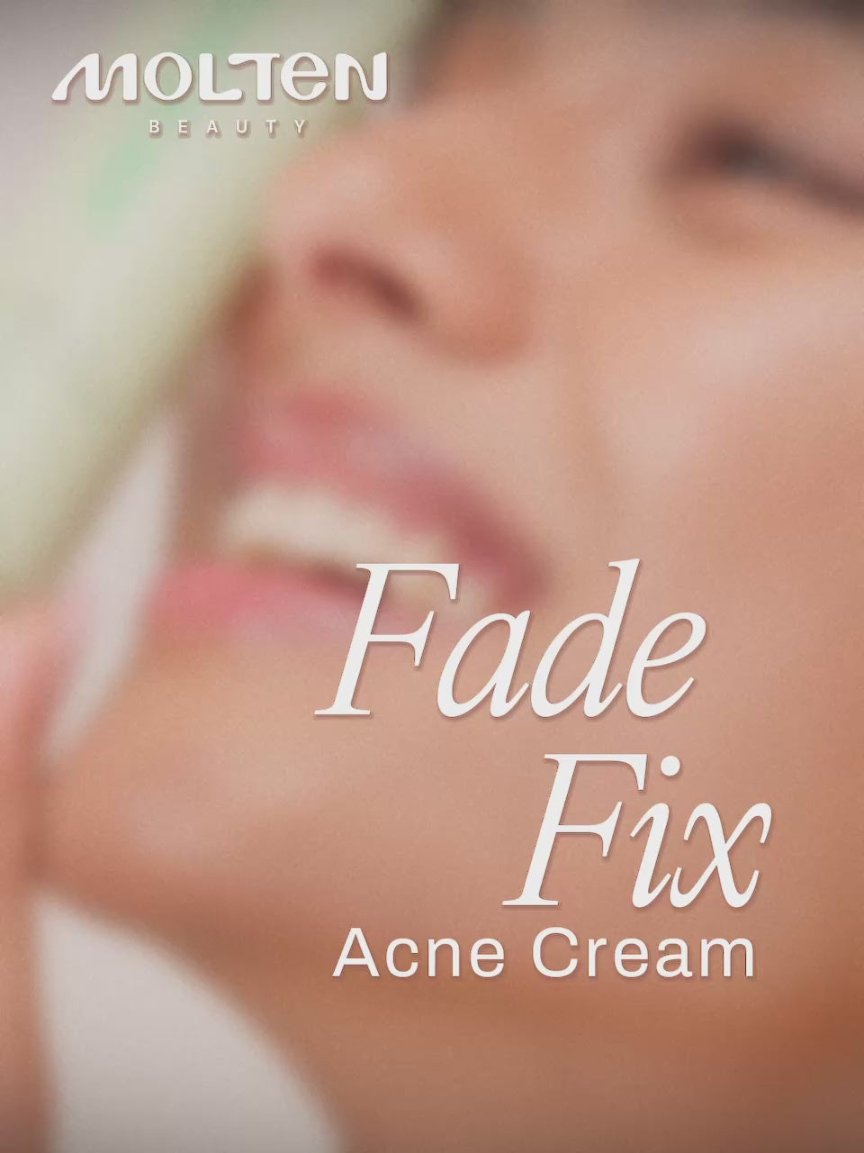 Fade Fix Acne Cream